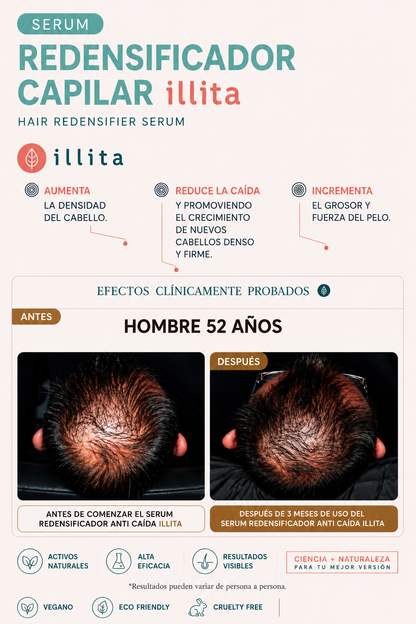 SERUM REDENSIFICADOR CAPILAR illita: Redensyl® Anti Caída + Densificador